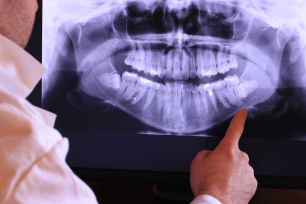 Best Emergency Treatment for Oral Infections in Montclair, VA