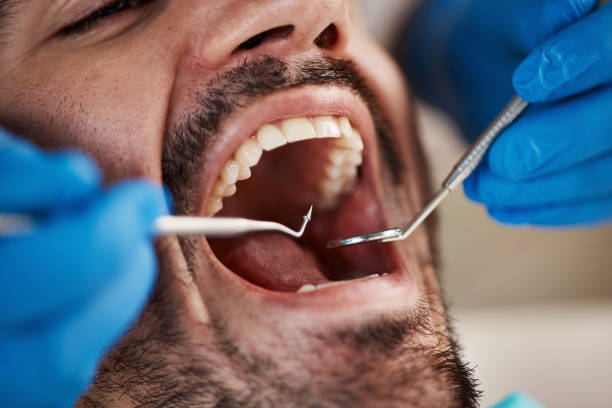 Best Emergency Cosmetic Dentistry (e.g., broken veneers) in Montclair, VA